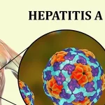 hepatitis a 1