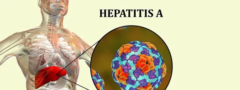 hepatitis a 1